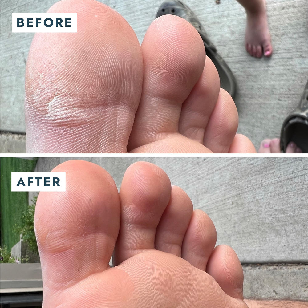 VOESH Solemate travel-size compact presents convenient travel foot care