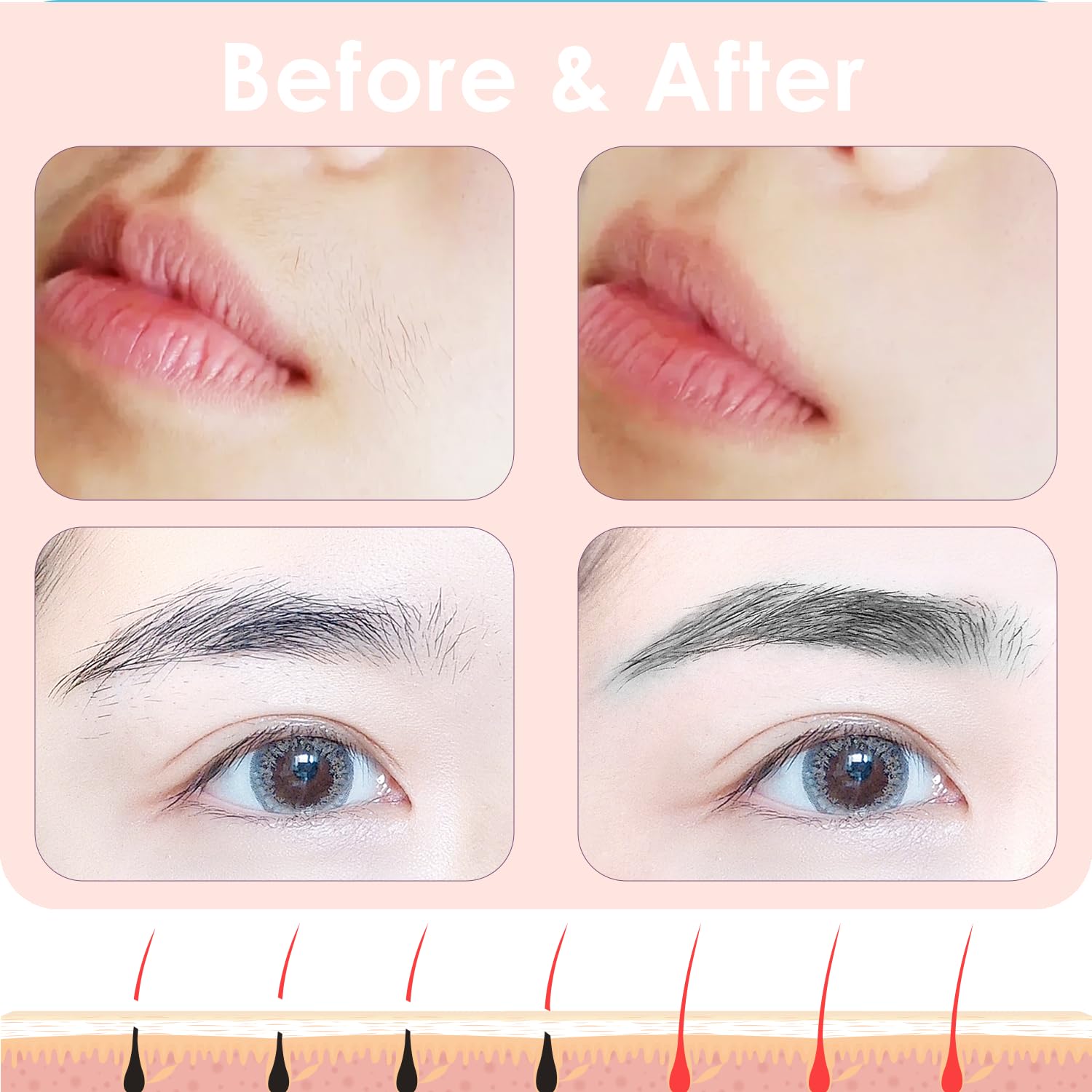 vogcrest replacement head vg-102 compatible with vg-1023 and vg-1024 models.