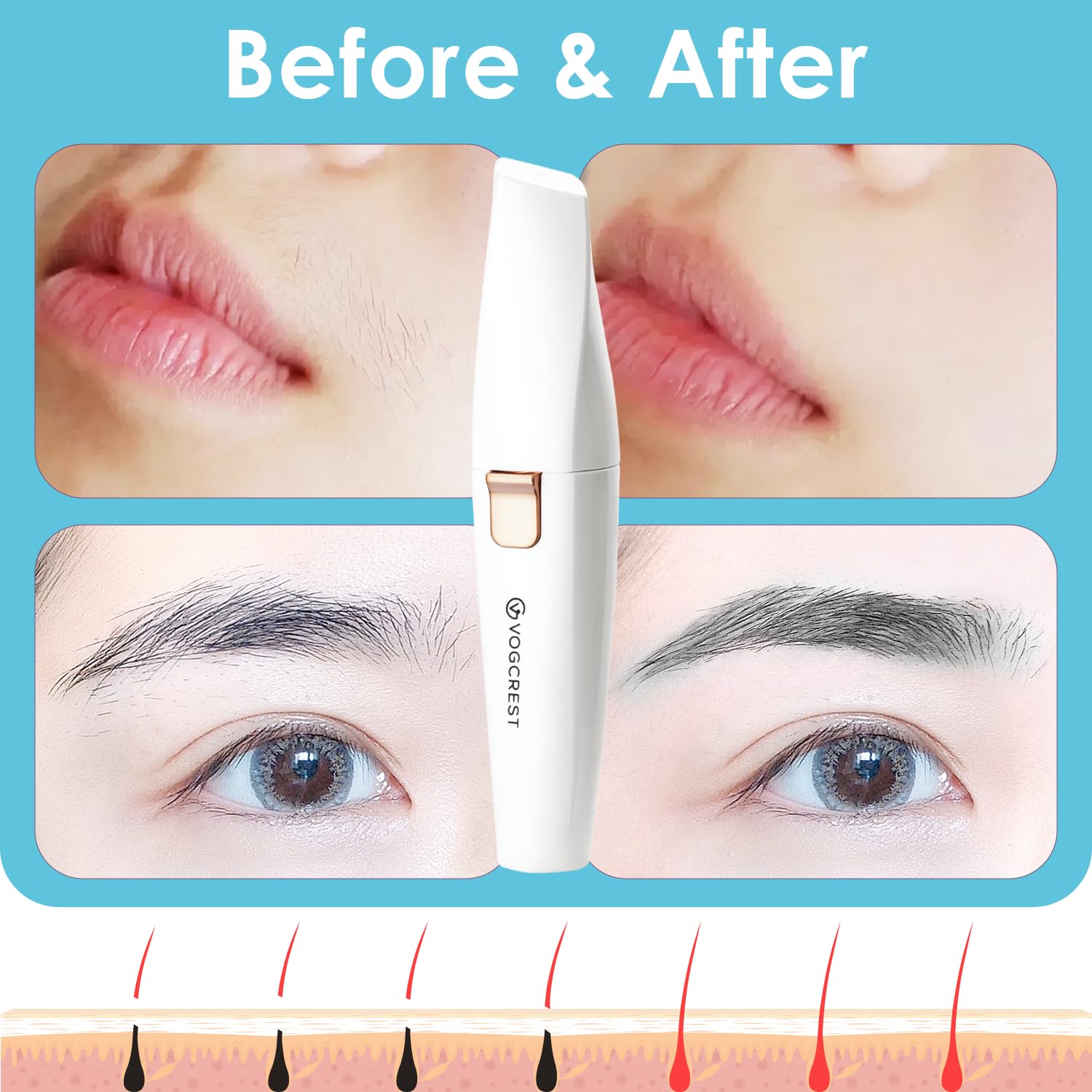 VG VOGCREST travel-friendly case keeps the remover protected on trips.