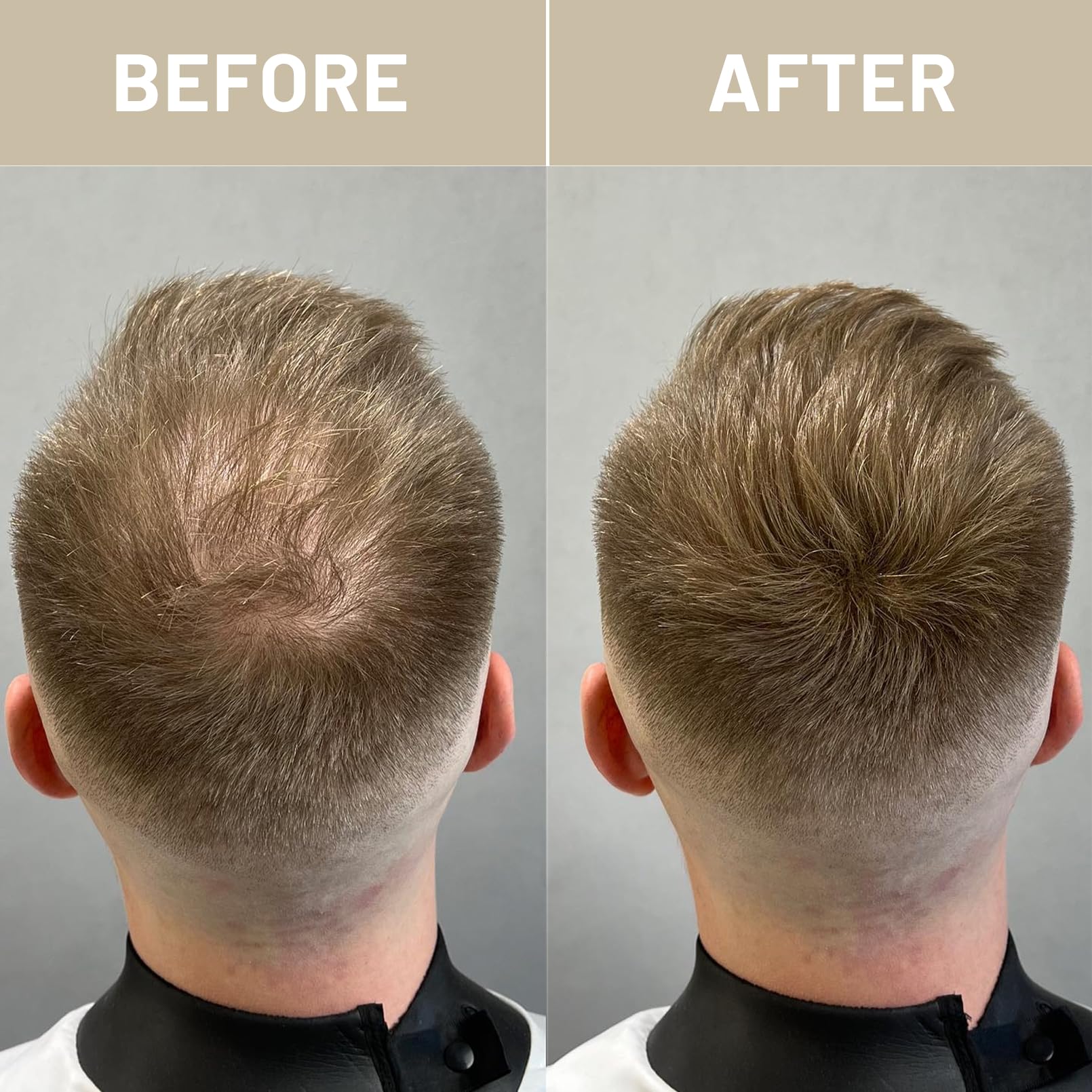 VOLLUCK Hair Fibers dispersion on hair shows even distribution and added volume.