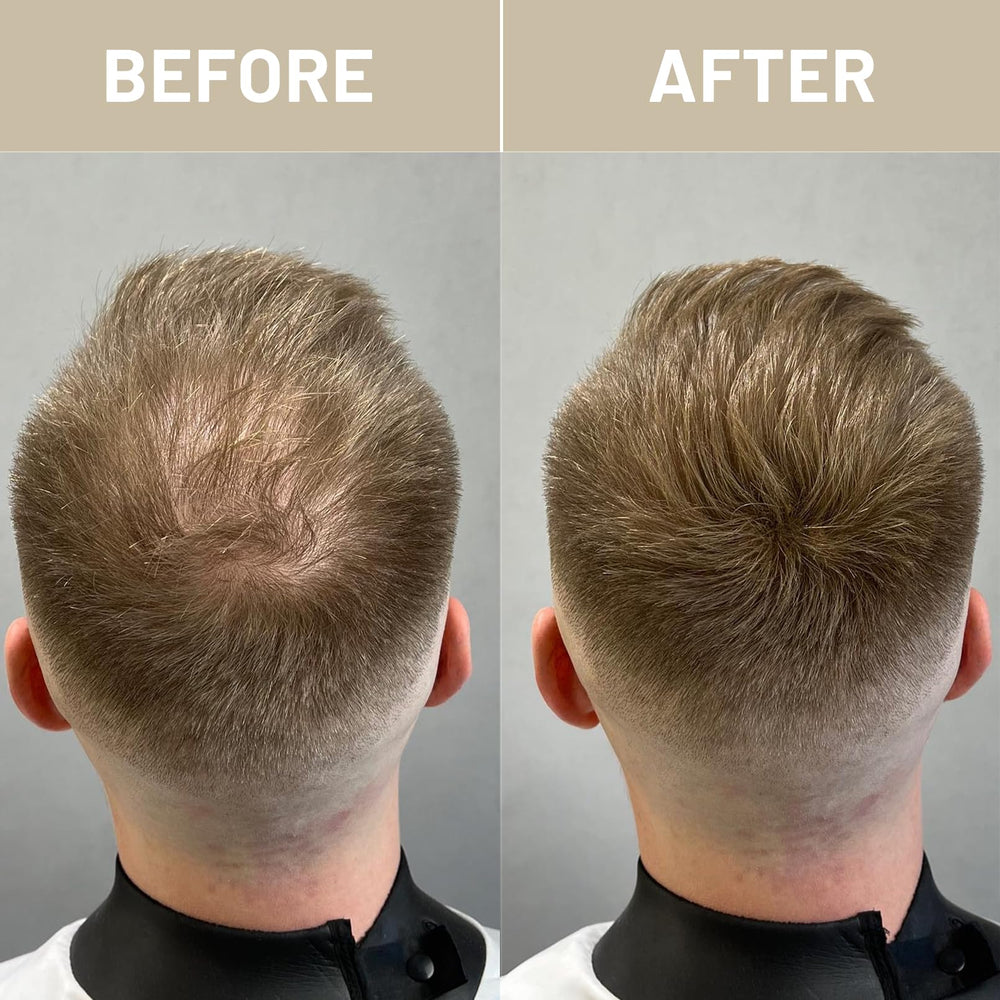 VOLLUCK Hair Fibers dispersion on hair shows even distribution and added volume.