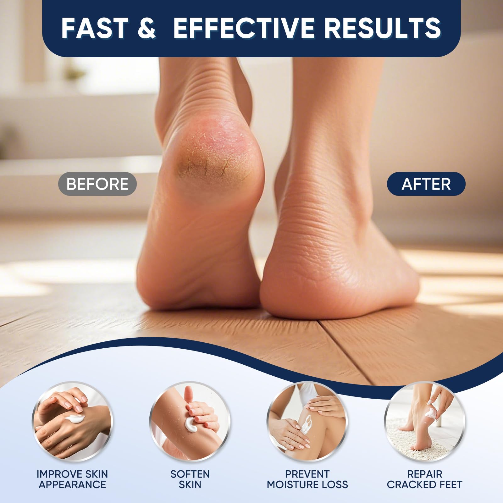 VREKEF Urea Cream 40% hand-application scene demonstrates hydration impact.