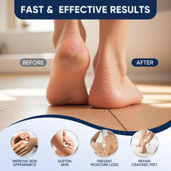 VREKEF Urea Cream 40% hand-application scene demonstrates hydration impact.