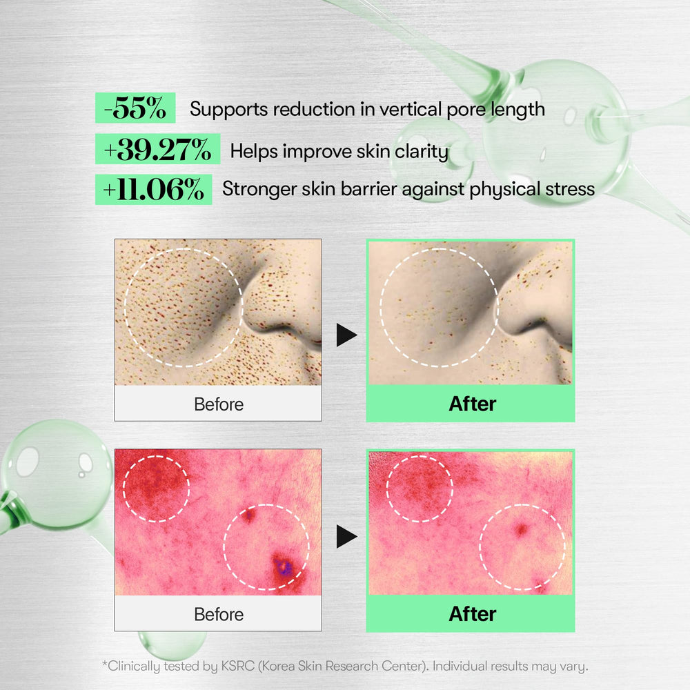 VT COSMETICS Reedle Shot microneedling close-up highlighting absorption boost