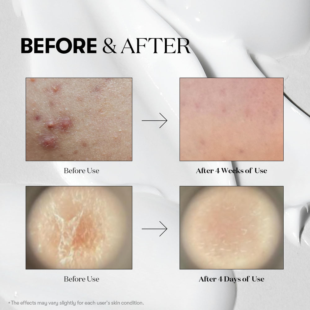 VT COSMETICS Reedle Shot 700 bottle revitalizes natural glow and vitality
