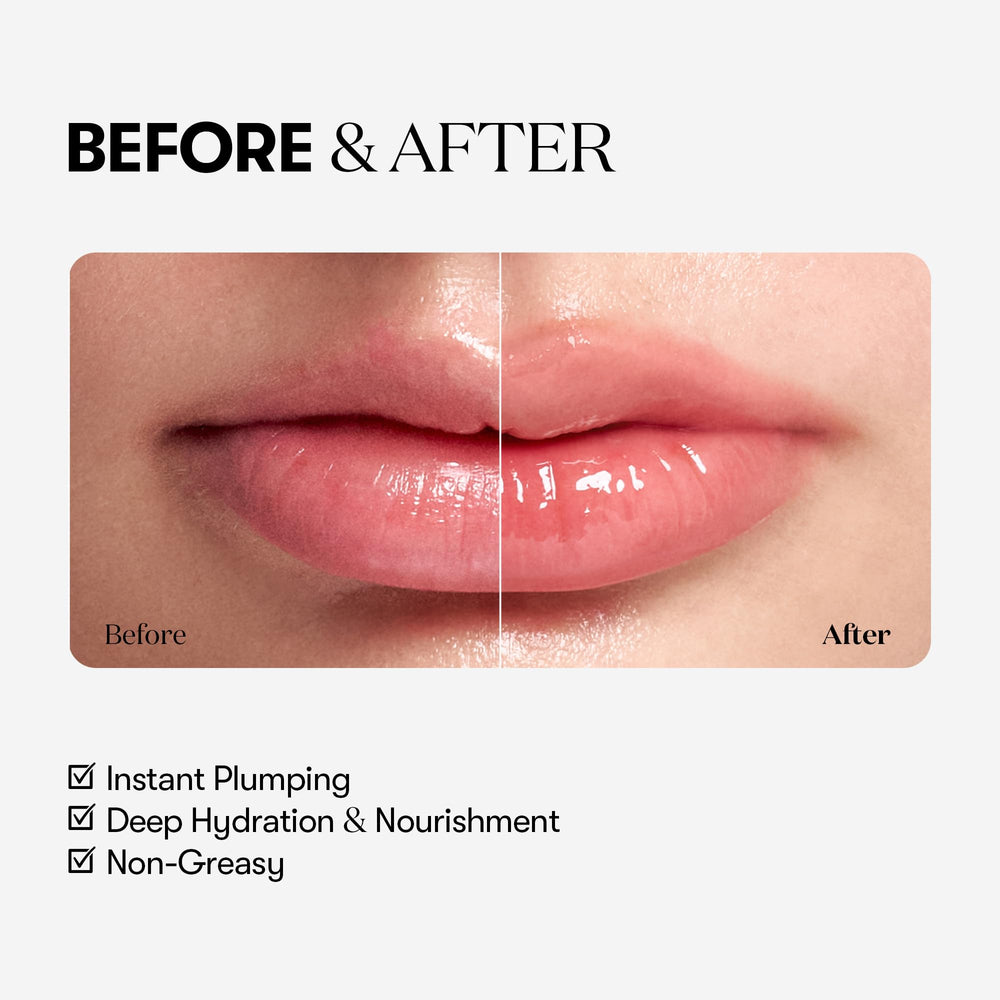 VT COSMETICS Reedle Shot micro-particles visible for gentle surface stimulation.