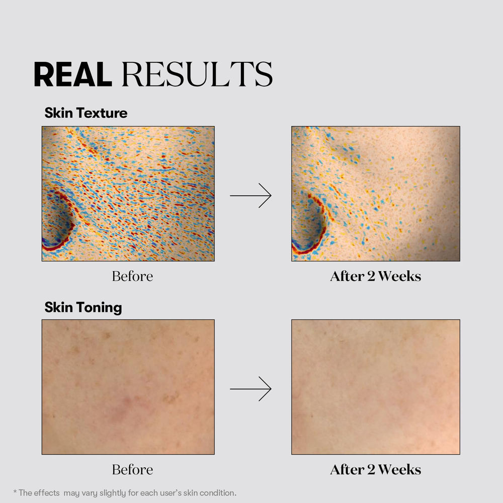 VT COSMETICS TX Toning Daily Mask hydration essence image emphasizes moisture-rich formula