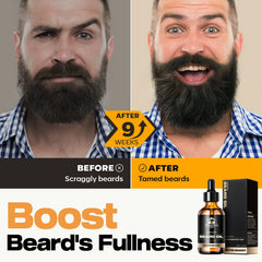 Waking Forest beard-oil-softening-texture highlights smoothing action for easier styling.
