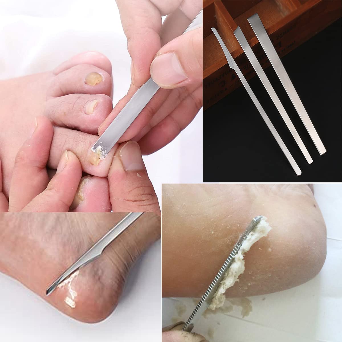 WANLIAN foot care tool in hand demonstrates portable home-use convenience