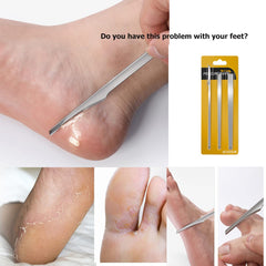 WANLIAN ingrown toenail set slice knife trims dead skin and calluses