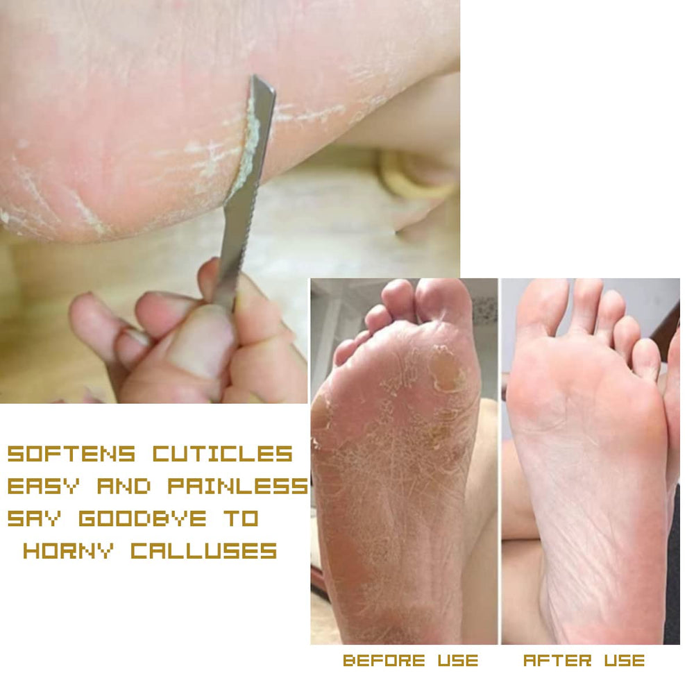 WANLIAN stainless steel pedicure knife closeup showing durable blade