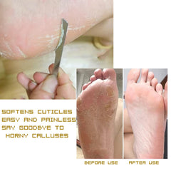 WANLIAN stainless steel pedicure knife closeup showing durable blade