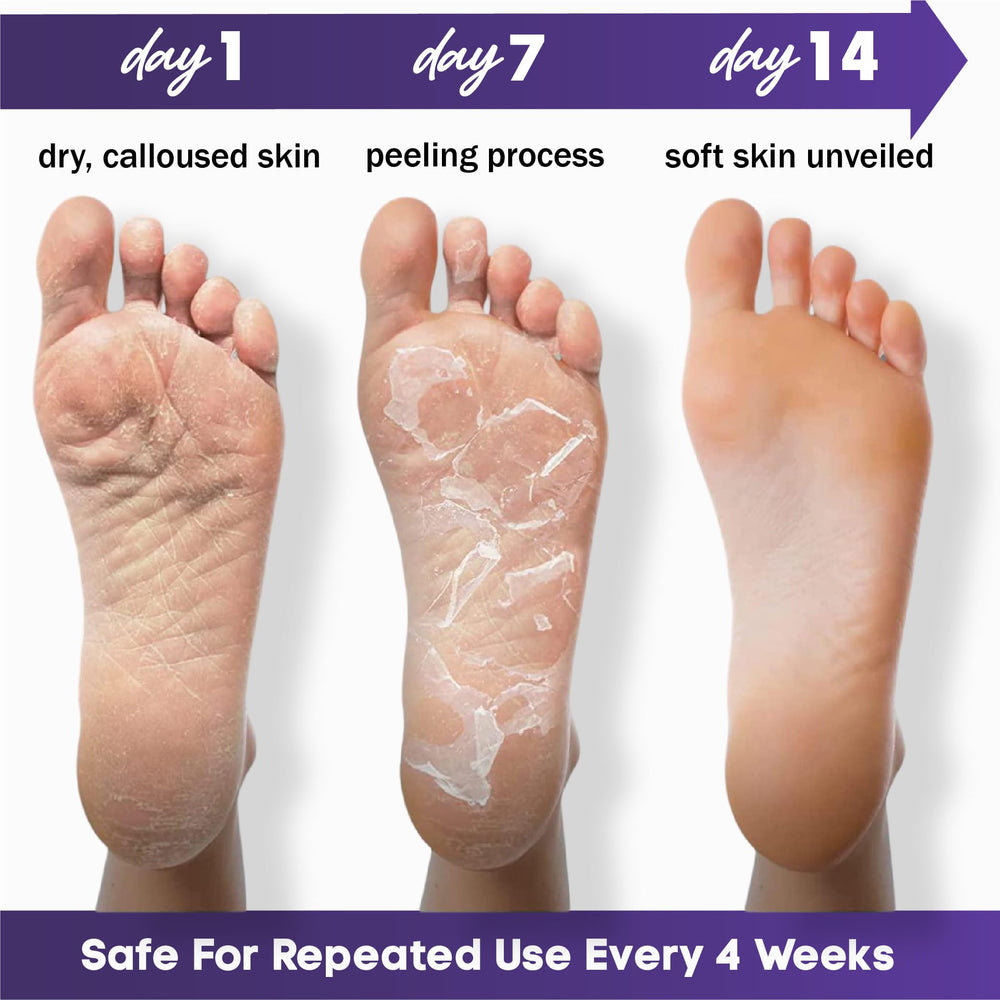 WARMWELLNESS two-pairs lavender foot mask for versatile foot care