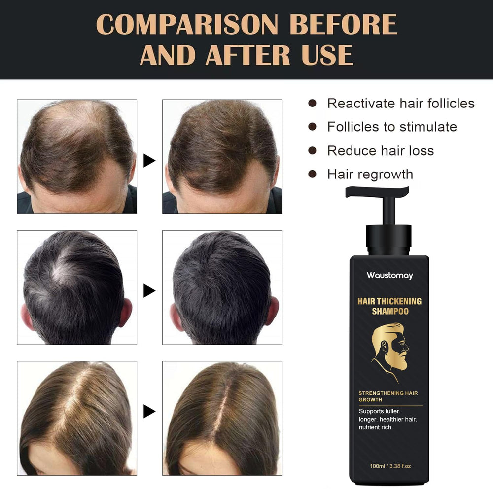 WAUSTOMAY Root Activator application on scalp demonstrates soothing touch for healthy environment