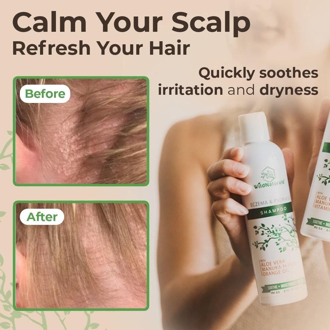 Wild Naturals psoriasis shampoo daily-use concept with gentle formula