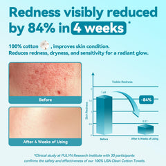Winner disposable face towel shows 100% cotton material for pure, soft cleansing.