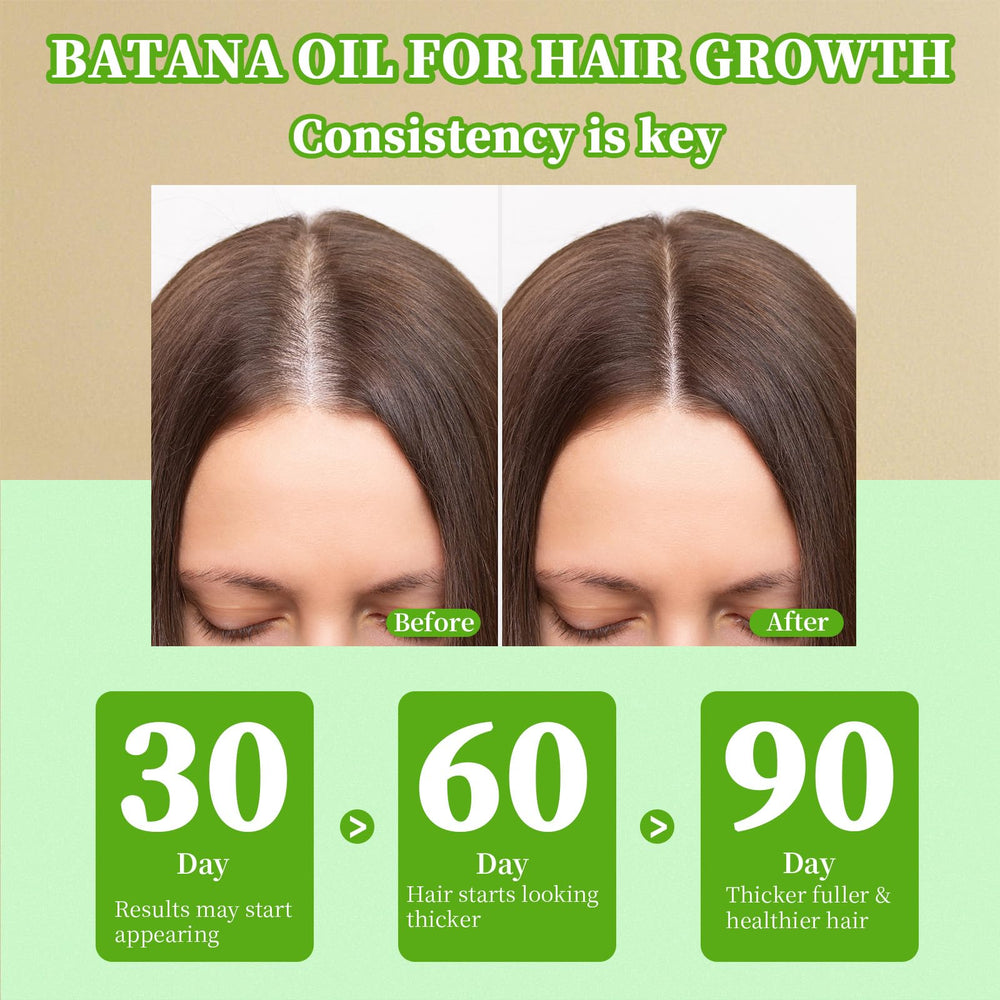 Wiqeerilly Batana Oil in hand, ready for scalp massage therapy.