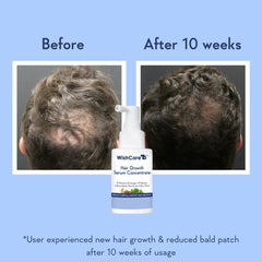 WishCare leave-on serum texture feels light and absorbs quickly for non-greasy results.