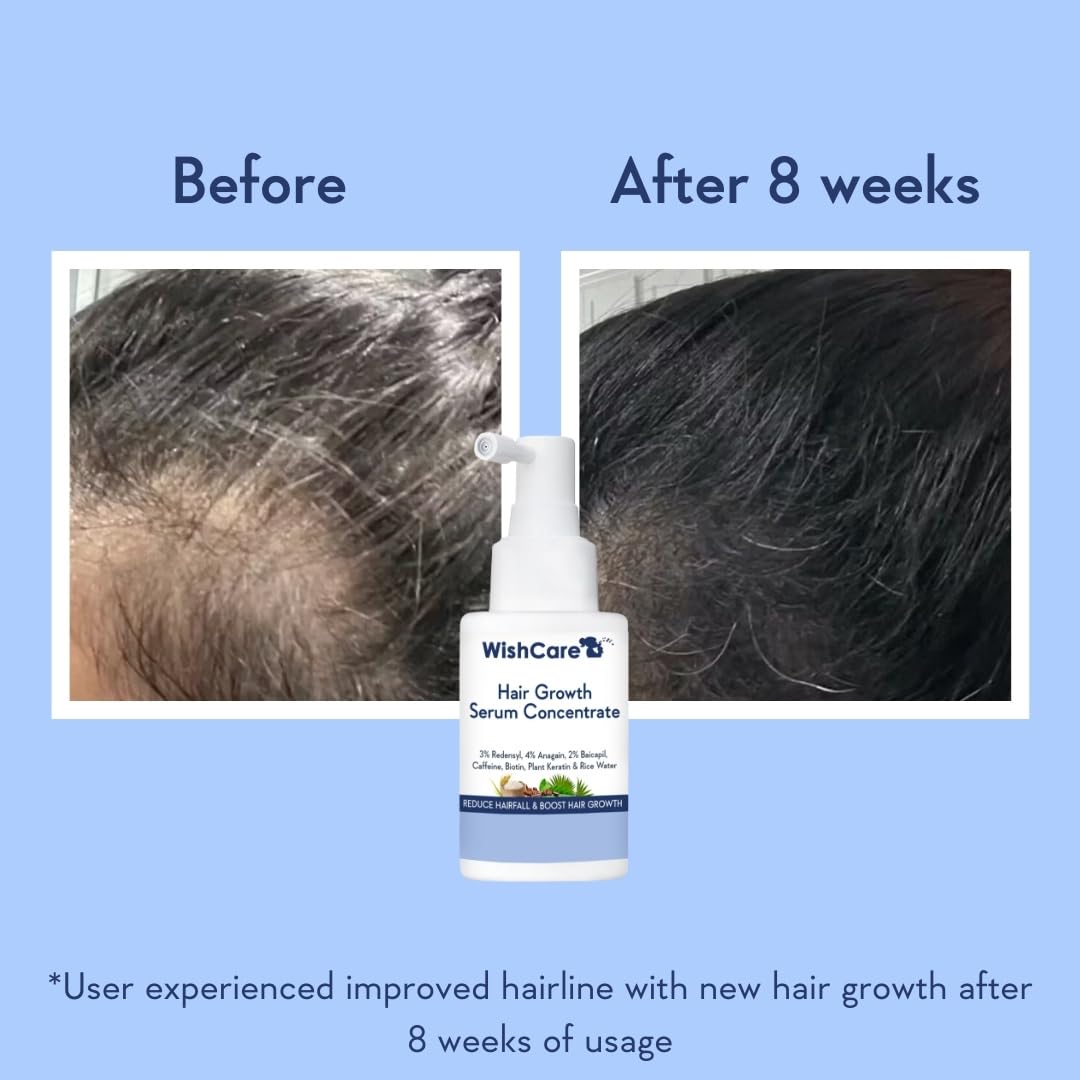 WishCare scalp-massage-use image demonstrates easy nightly routine for improved hair vitality.