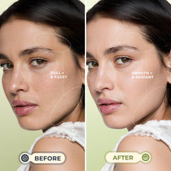 WLU Dermaplane Razor Green sonic vibrations demonstrate gentle skin exfoliation