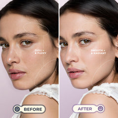 WLU LED blade light aids accuracy during dermaplaning at home.