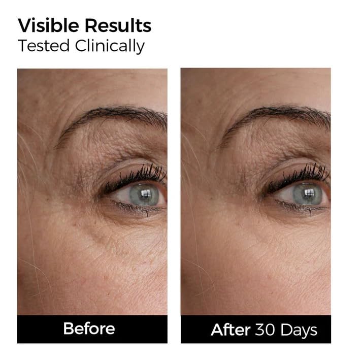 WNP 4D hyaluronic acid close-up showing multi-layer hydration and plumpness.