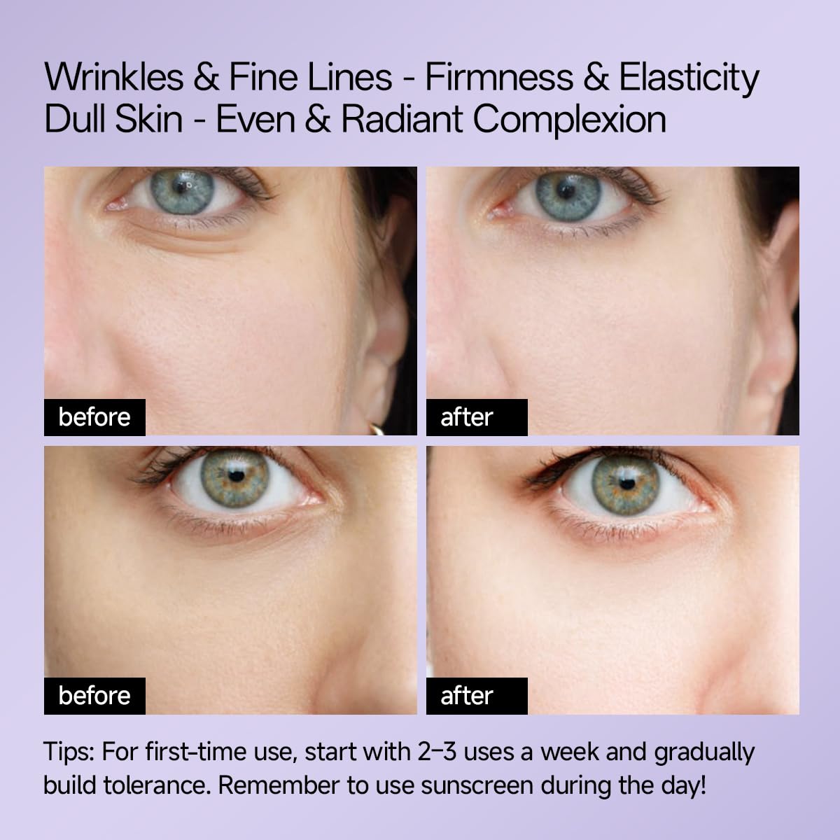 WNP Gentle Retinol Cream on skin showing firmness and hydration