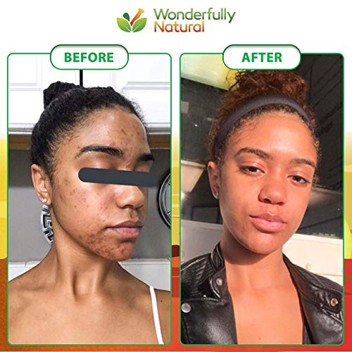 Wonderfully Natural African Black Soap bar side profile showing texture for smoother skin