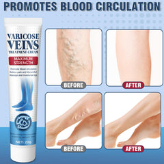 Wonshine varicose veins cream natural oils close-up highlights aloe and sunflower benefits.