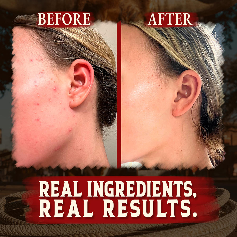 Wrath & Remedy grass-fed beef tallow balm for full-body care closeup