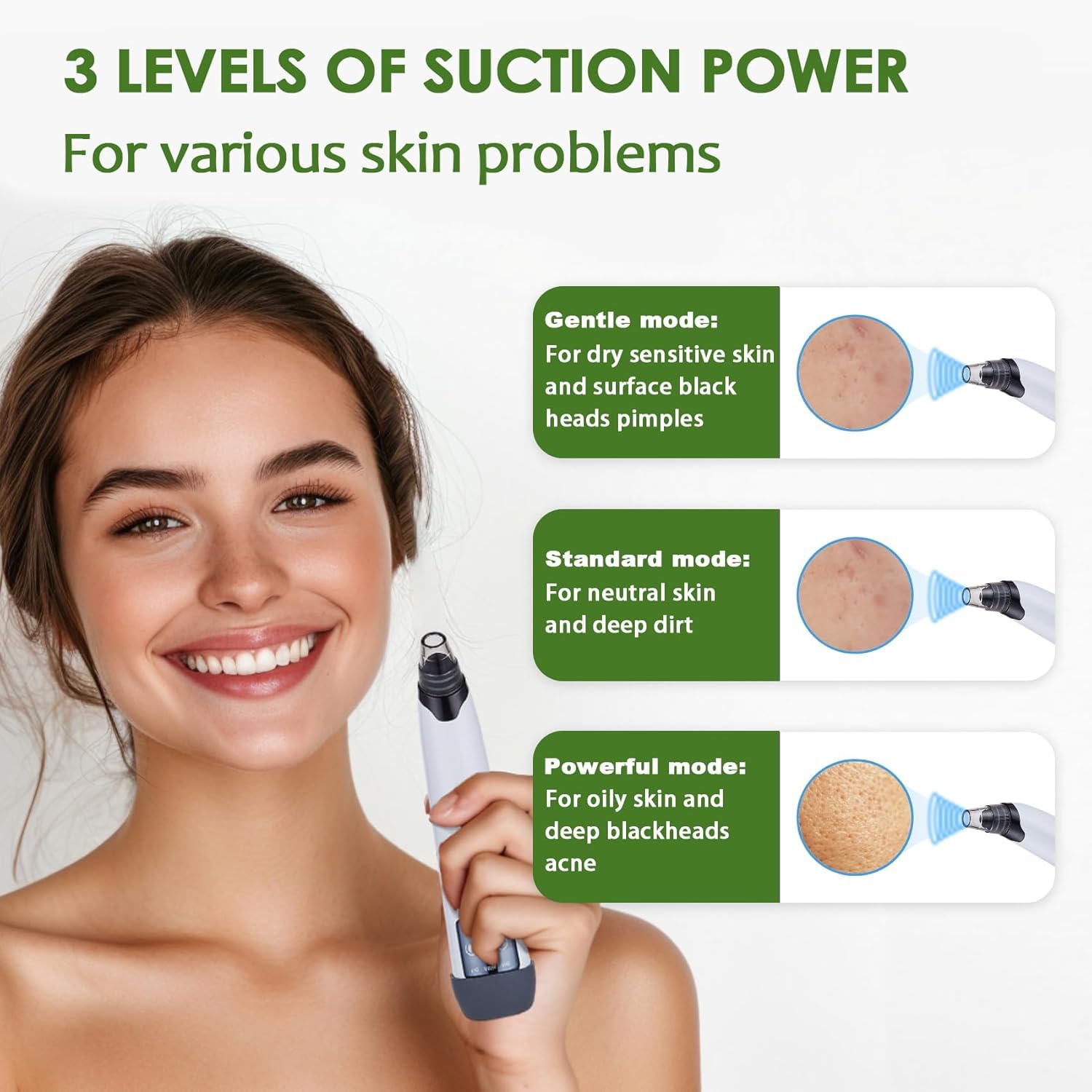 Xamoca Blackhead Remover Vacuum suction levels knob close-up for customizable cleansing