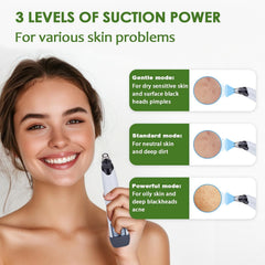 Xamoca Blackhead Remover Vacuum suction levels knob close-up for customizable cleansing