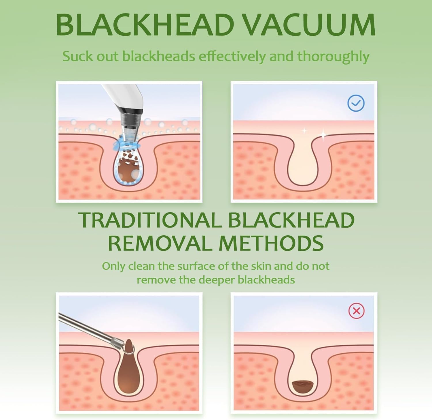 Xamoca Skin cleansing after use close-up showing refreshed pores