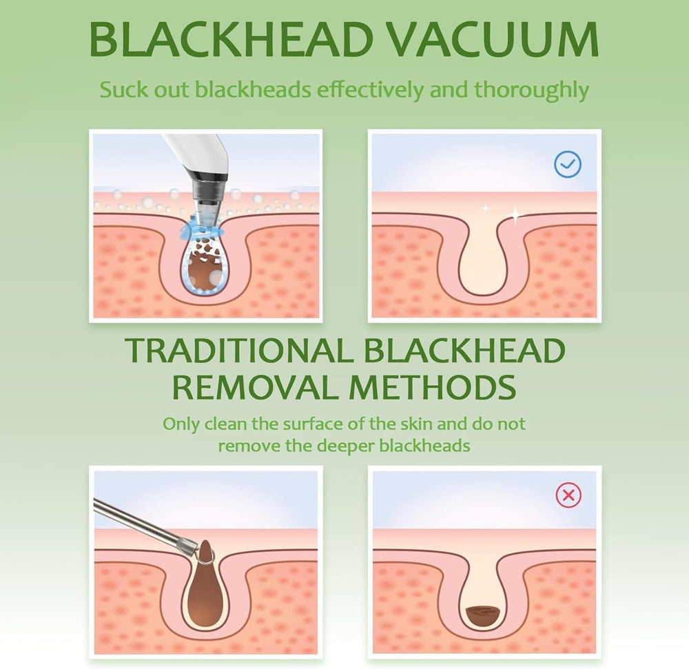 Xamoca Skin cleansing after use close-up showing refreshed pores