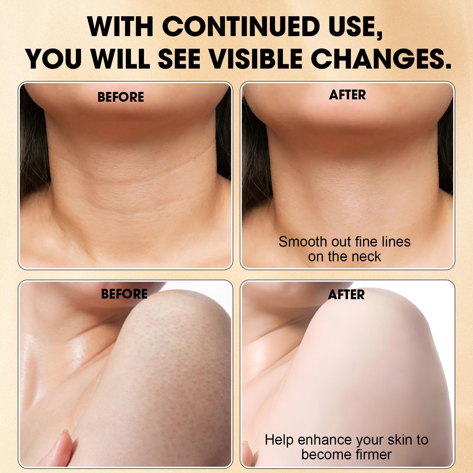 Xaninp Champagne Cream on legs demonstrates a lifted, contoured look.
