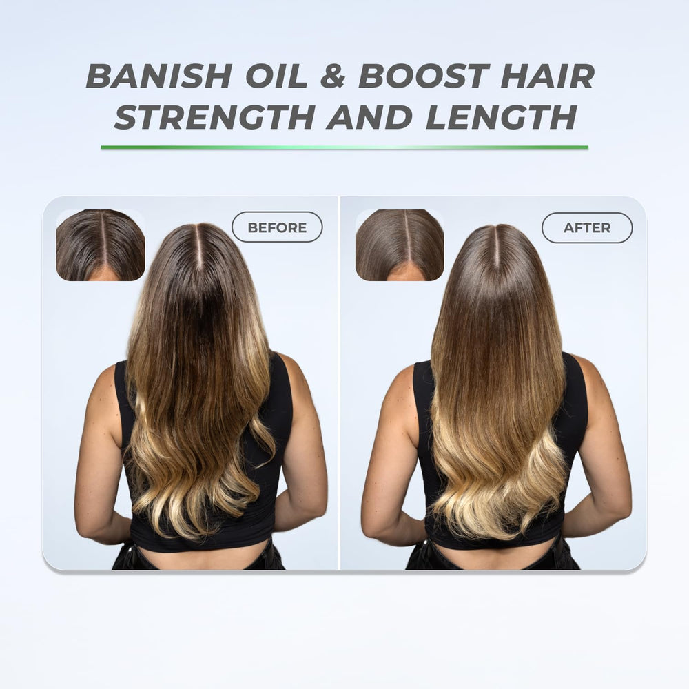 XMONDO Hair BOOST X packaging emphasizes talc-free and benzene-free commitments