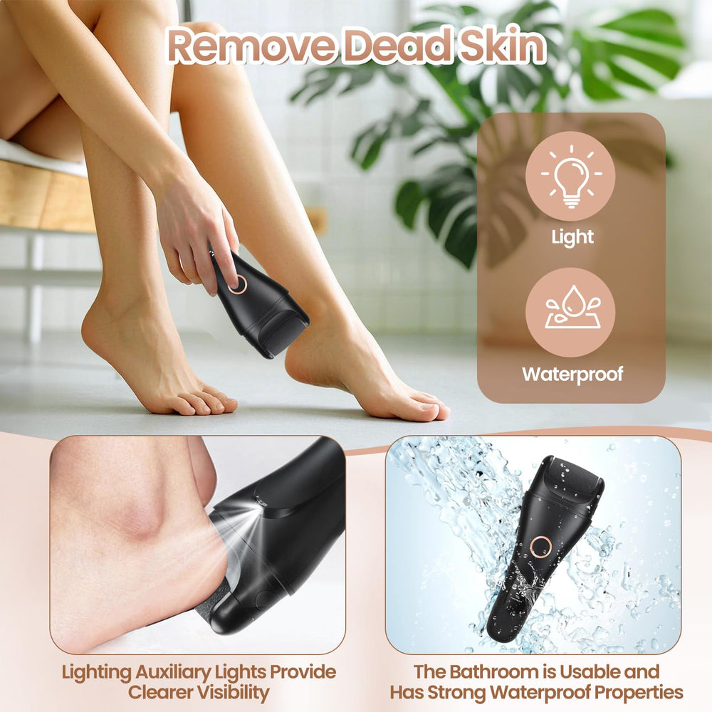 Xytrue Coarse roller removes thick calluses efficiently.