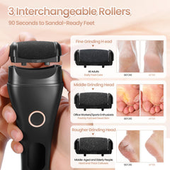 Xytrue Medium roller targets heels for smoother skin.