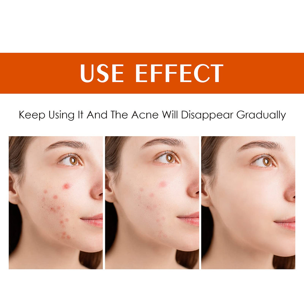 Back view of YAFUSIPE acne treatment for body breakouts with moisturizing care.