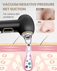 Yagetu pore vacuum attachments probes illustrate versatile tools for facial areas.