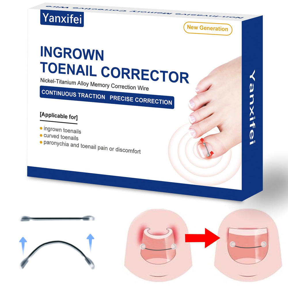 Yanxifei nitinol ingrown toenail corrector kit packaging shows easy setup for home relief.