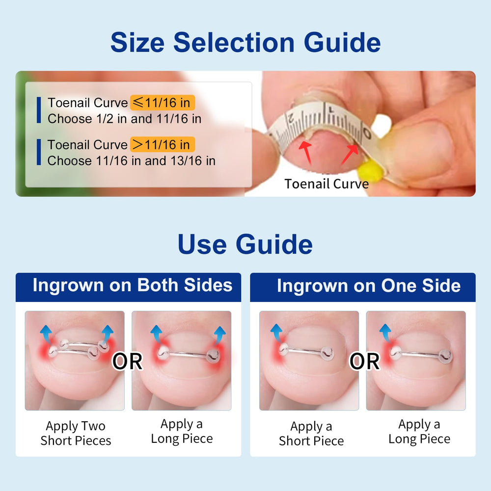 Yanxifei step-by-step instructions guide simple, safe nail correction process.