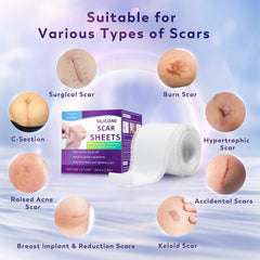 Yarster silicone scar sheets cut-to-fit for precise coverage on awkward areas.