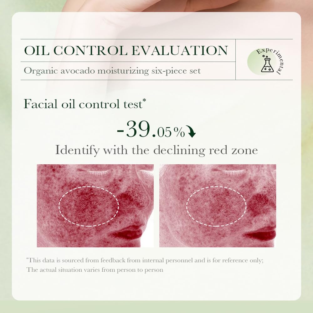 Yasovigi Avocado Skincare Kit moisturizing cream—rich hydration for softness.