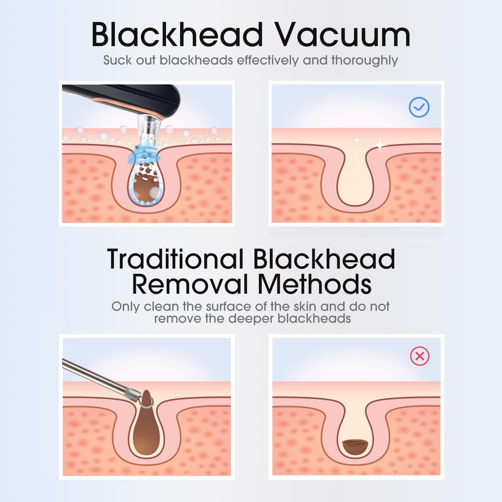 Yccu blackhead remover vacuum portable size fits travel bags for easy skincare anywhere.