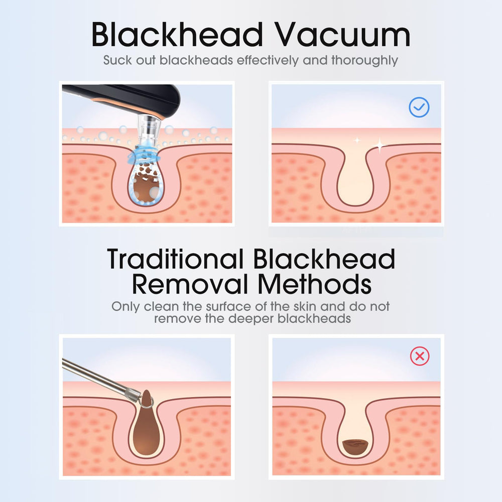 Yccu blackhead remover vacuum portable size fits travel bags for easy skincare anywhere.