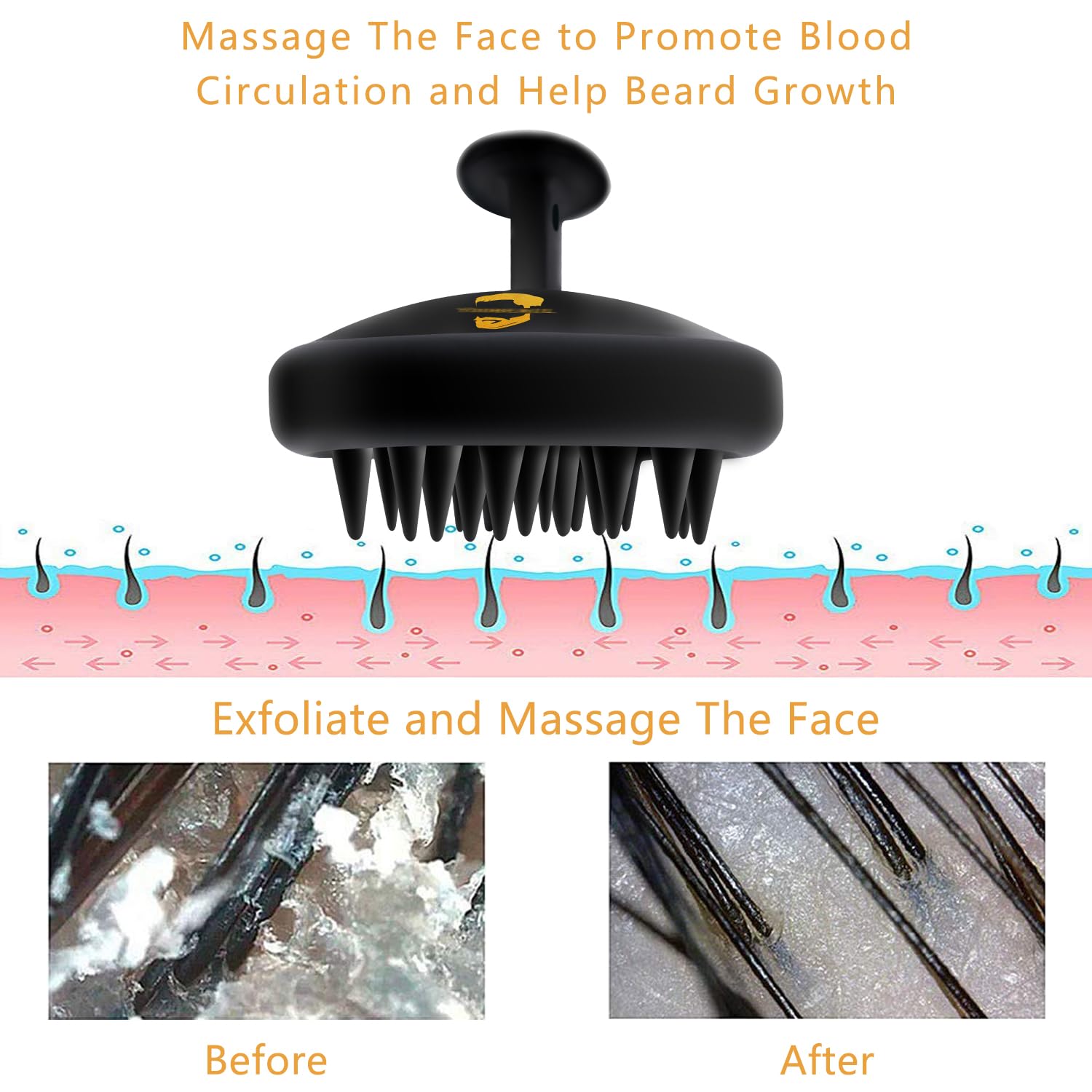 YEALIR Hydrated skin under beard emphasizes relief from dryness