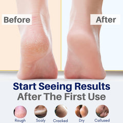 The Yellow Bird organic foot balm pump demonstrates concentrated moisturization for dry heels.