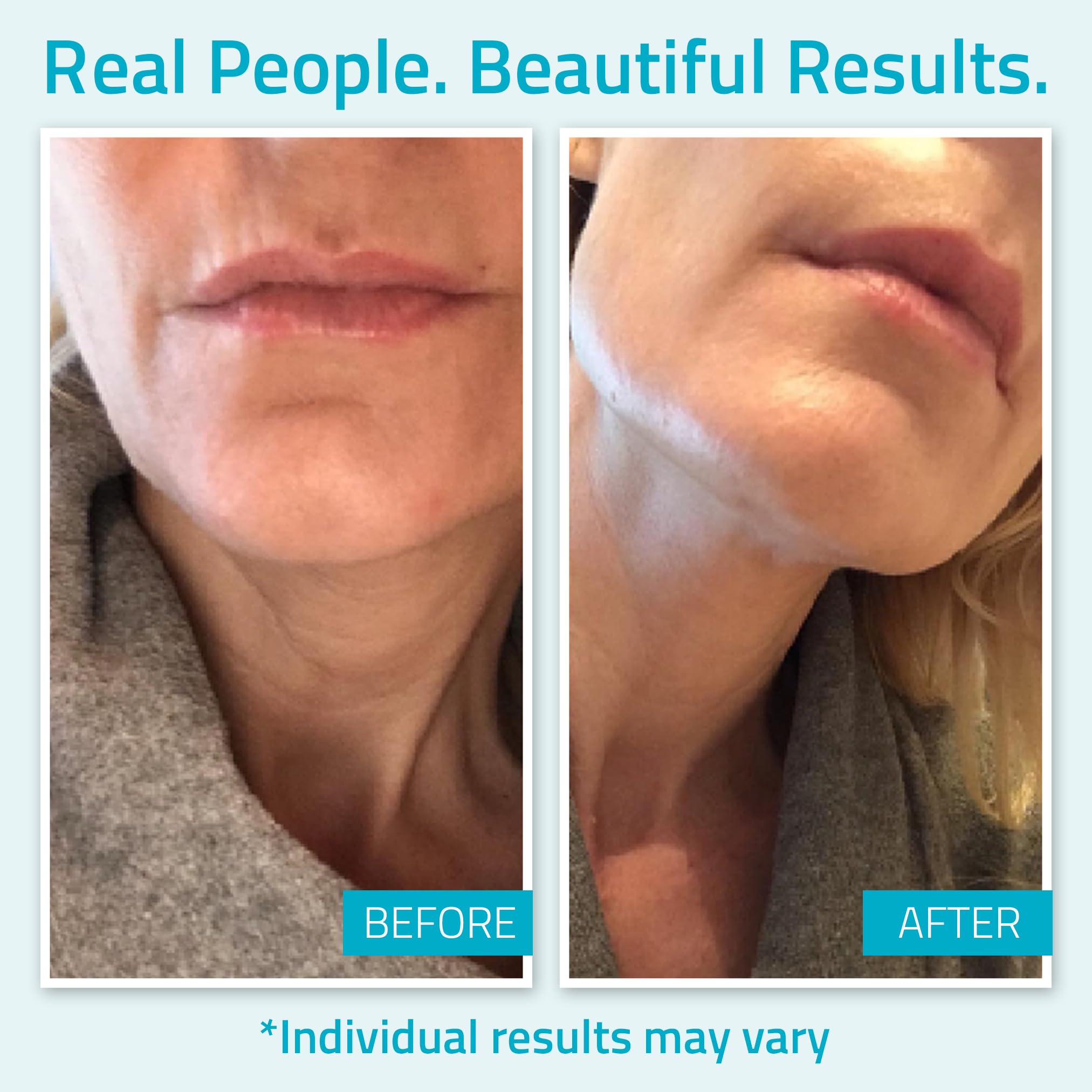 YEOUTH Copper Tripeptide-1 focus – supports skin resilience.