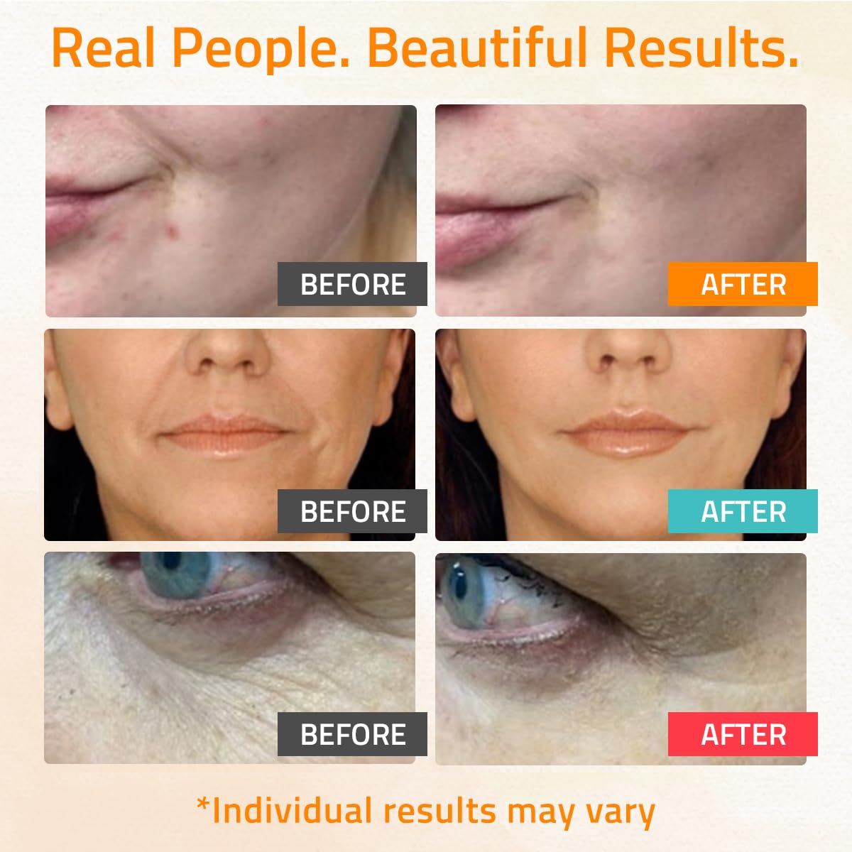 YEOUTH hyaluronic acid serum 99% pure for moisture and plumpness